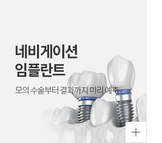 네비게이션임플란트